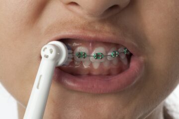 Why you should be Using Toothbrush For Braces 2