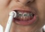 Why you should be Using Toothbrush For Braces 8